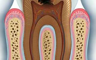 Халатность и безразличие приведут к потере зубов! Глубокий кариес: симптомы и последствия