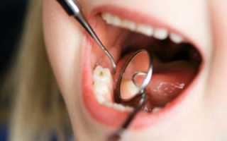 Ребенок также подвержен развитию патологий полости рта! Лечение кариеса у детей