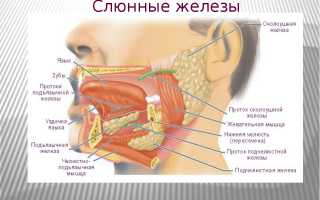 Плеоморфная аденома околоушной слюнной железы