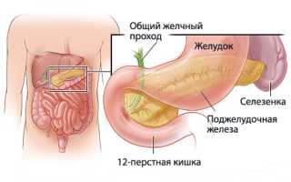 Симптомы рака поджелудочной железы