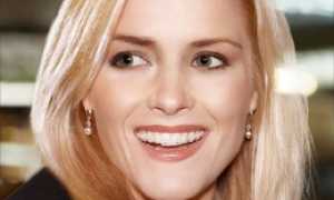 Брекеты для взрослых: особенности, продолжительность ношения и виды