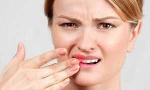 Стоматологи объясняют, почему после лечения зуба больно на него нажимать