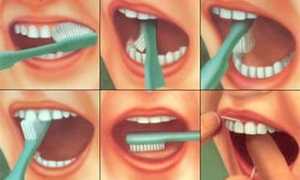 Профилактика зубного камня