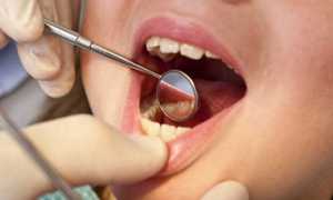 Почему так сложно лечить пульпит у детей и как его вовремя обнаружить?