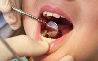 Почему так сложно лечить пульпит у детей и как его вовремя обнаружить?