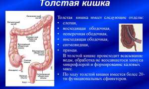 Что такое бластома толстой кишки?