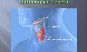 Папиллярная карцинома щитовидной железы: лечение и выживаемость