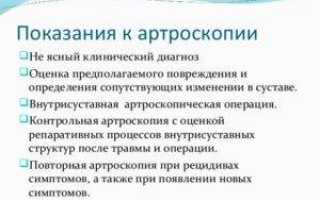 Причины и лечение отека коленного сустава