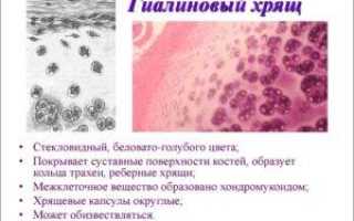 Как лечить истончение гиалинового хряща коленного сустава