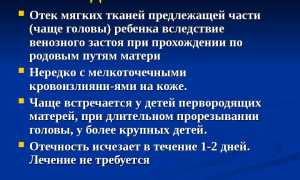 Родовая опухоль у детей