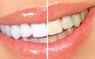 Какие самые эффективные средства для отбеливания зубов можно найти в аптеках?