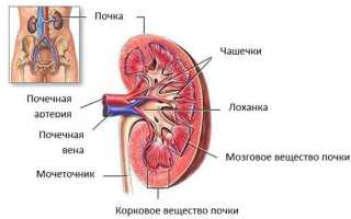 Опухоль почек: симптомы, лечение и удаление опухоли