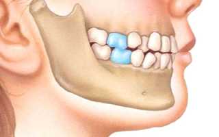 Красивая улыбка в результате интенсивных тренировок! Как исправить прикус в домашних условиях?