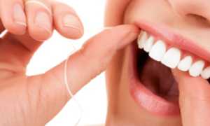 Необходимый аксессуар в борьбе с кариесом! Зубная нить: что это такое