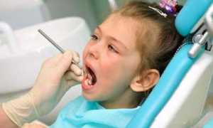 Чем опасен периодонтит у детей и как предотвратить заболевание?
