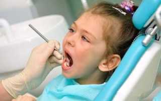 Чем опасен периодонтит у детей и как предотвратить заболевание?