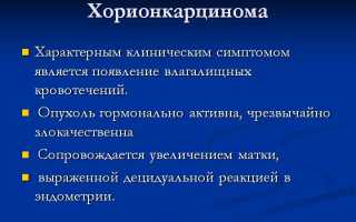 Хориокарцинома: симптомы и лечение