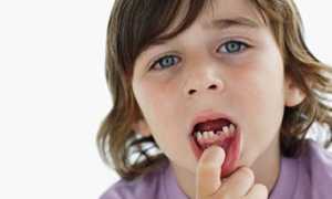 Этиология зубной боли у детей, методы ее лечения и профилактики