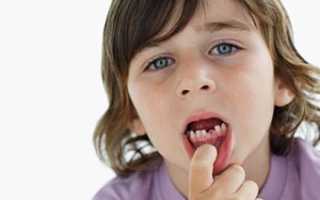 Этиология зубной боли у детей, методы ее лечения и профилактики