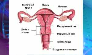 Фиброма вульвы: симптомы и лечение