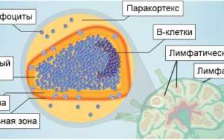 Лимфома из клеток мантийной зоны