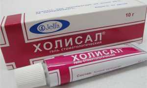 Лечим гингивит в домашних условиях