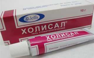 Лечим гингивит в домашних условиях