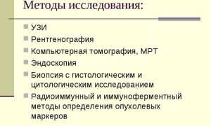 Методы диагностики опухолей мозга