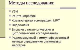 Методы диагностики опухолей мозга