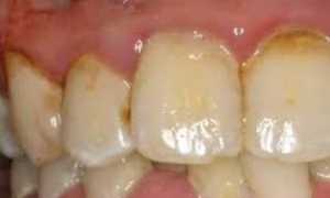 Как снимают