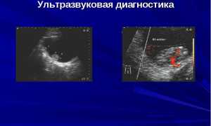 Диагностика злокачественных опухолей