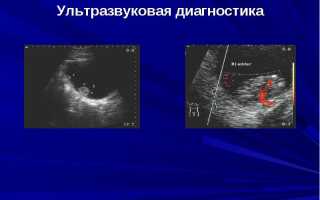 Диагностика злокачественных опухолей
