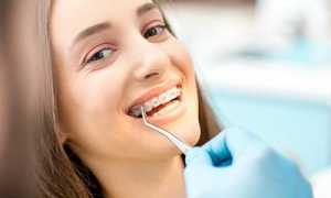 Зачем нужны скобы? Установка брекетов – верный путь к здоровым зубам