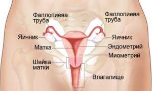 Рак матки и его лечение