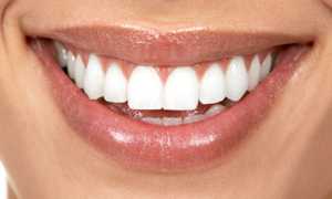 Сияющая белизна: несколько способов отбеливания зубов народными средствами