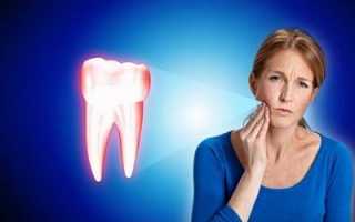 Что делать, если болит зуб под коронкой, хотя нерв удален? Основные причины дискомфорта