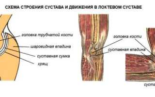 Что лучше: мрт или кт при обследовании крупных суставов