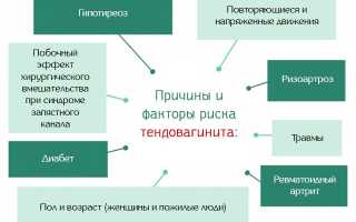 Что такое тендинит коленного сустава?