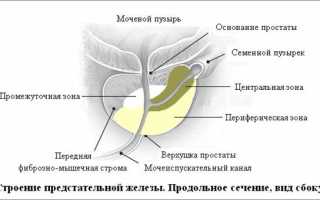 Рак простаты: симптомы и лечение