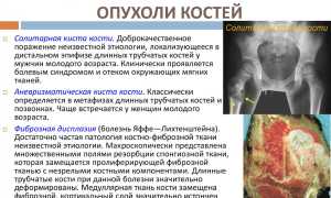 Как лечат разные стадии бластомы костей?