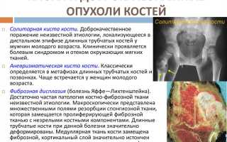 Как лечат разные стадии бластомы костей?