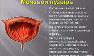 Что такое бластома мочевого пузыря?