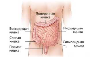 Симптомы и лечение опухоли сигмовидной кишки