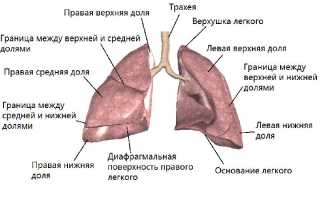 Липома легкого