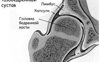 Опухоль бедра: симптомы, диагностика и лечение