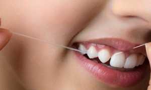 Эффективное средство гигиены полости рта в дополнение к основным! Зубная нить: виды