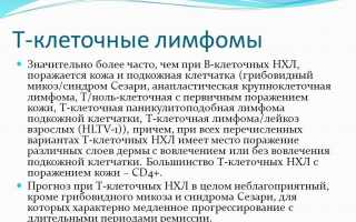Т-лимфома – стадии и лечение