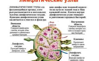 Опухоль лимфатических узлов: как лечить?