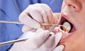 Зубная боль при периодонтите