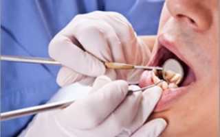 Зубная боль при периодонтите